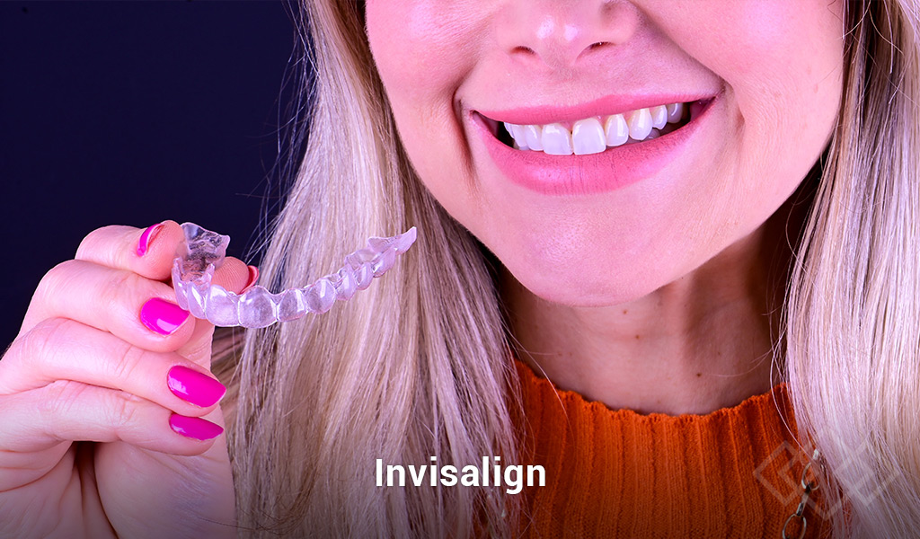 Invisalign